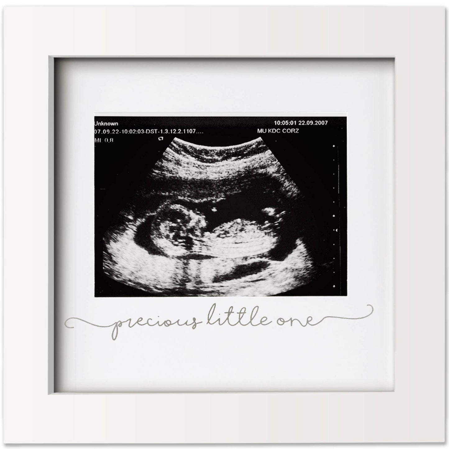 KeaBabies Solo Baby Sonogram Picture Frame: Alpine White